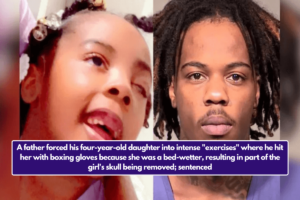 A father forced his four-year-old daughter into intense "exercises" where he hit her with boxing gloves because she was a bed-wetter, resulting in part of the girl's skull being removed; sentenced