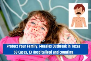 Protect Your Family Measles Outbreak in Texas 58 Cases, 13 Hospitalized and counting